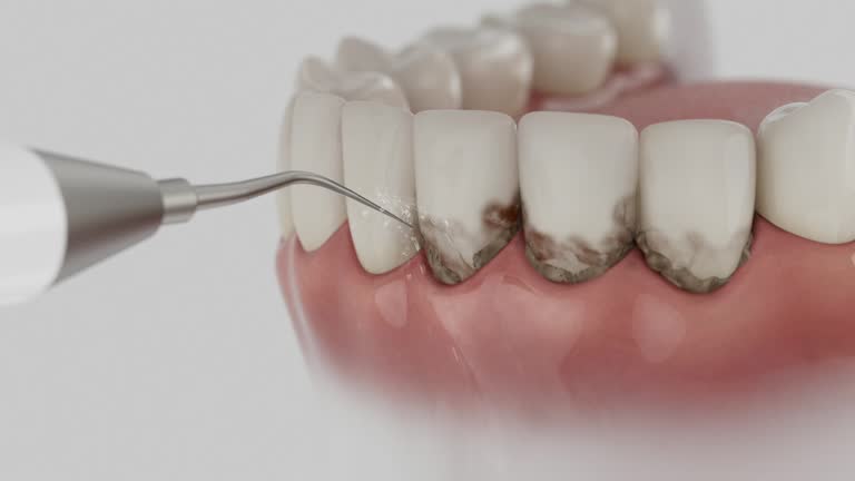 Trusted Tooth Extraction service in Loretto, TN - Dentist Open Now